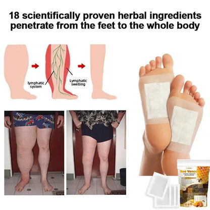 🐝👣 MD Bee Detox Foot Patches 🌿